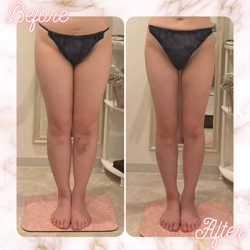 Before/After 下半身