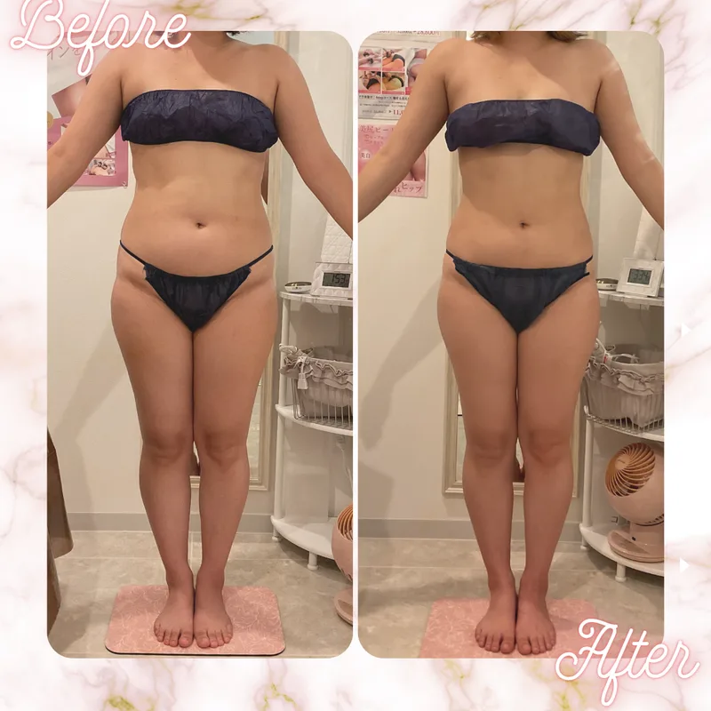Before/After 全身